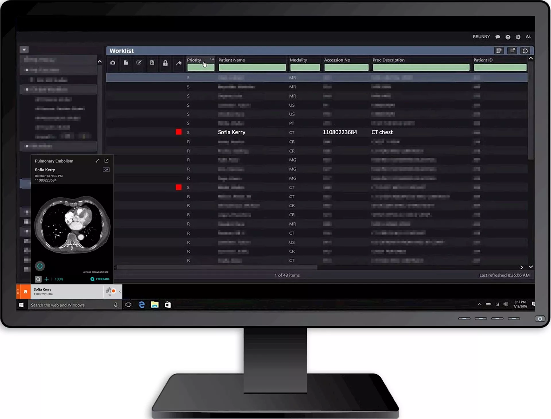 WellSpan York Hospital launches Aidoc's innovative AI solution to aid radiologists in flagging abnormalities in scans